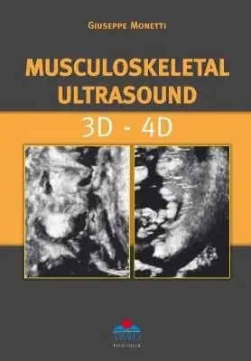 Musculoskeletal ultrasound. 3D-4D Ultime Pezzi