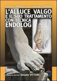 Affare L‘alluce valgo e il suo trattamento con tecnica endolog