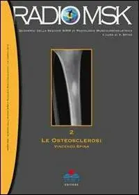 Le osteosclerosi. Vol. 2 Ultimissimo Modello