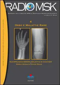 Osso e malattie rare Offerta