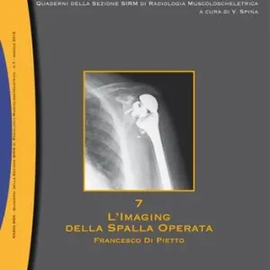L‘imaging della spalla operata. MSK. Vol. 7 Compra Oggi Stesso