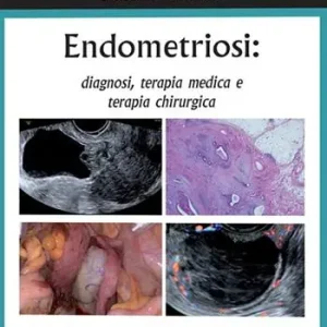 Promo Stagionale Endometriosi diagnosi, terapia medica e terapia chirurgica