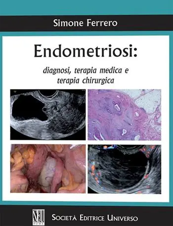 Promo Stagionale Endometriosi diagnosi, terapia medica e terapia chirurgica