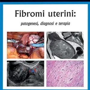 Fibromi uterini patogenesi, diagnosi e terapia Consegna Rapida