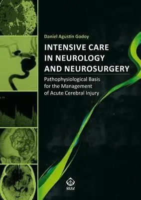 Intensive care in neurology and neurosurgery. Pathophysiological basis for the management of acute cerebral injury Promozione Esclusiva