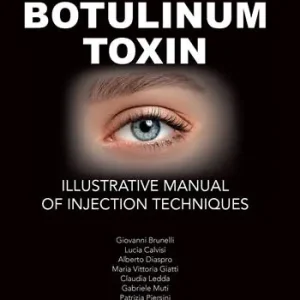 Offerta Botulinum toxin. Ilustrative manual of injection techniques. Ediz. a colori