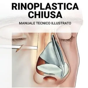 Affare Rinoplastica chiusa. Manuale tecnico illustrato