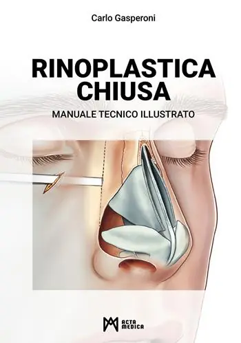 Affare Rinoplastica chiusa. Manuale tecnico illustrato