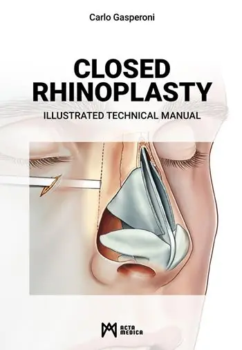Offerta Speciale Closed rhinoplasty. Illustrated technical manual