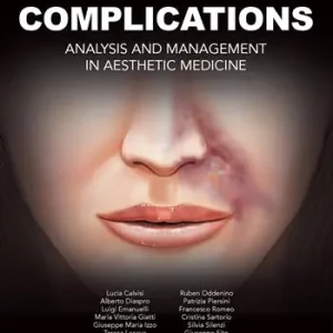 Complications. Analysis and management in aesthetic medicine. Ediz. illustrata Sconto