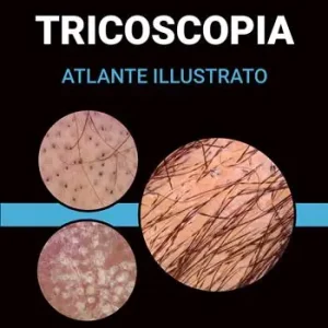 Tricoscopia. Atlante illustrato. Ediz. illustrata Spedito Oggi