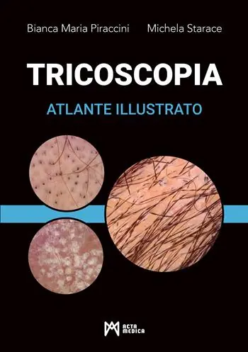 Tricoscopia. Atlante illustrato. Ediz. illustrata Spedito Oggi