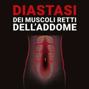 Diastasi dei muscoli retti dell’addome Professionale