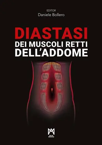 Diastasi dei muscoli retti dell’addome Professionale